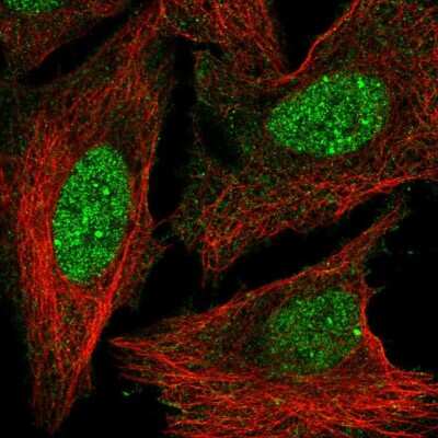 Immunocytochemistry/ Immunofluorescence: HOXD3 Antibody [NBP2-56817]