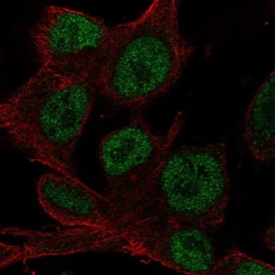 Immunocytochemistry/ Immunofluorescence: HOXD4 Antibody [NBP2-49631]