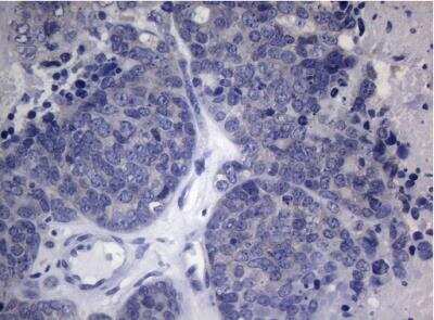 Immunohistochemistry-Paraffin: HOXD4 Antibody (OTI1E9) [NBP2-46001]