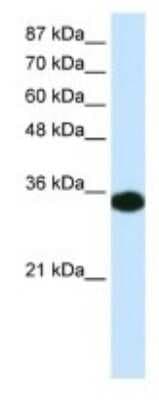 Western Blot: HOXD4 Antibody [NBP3-11018]