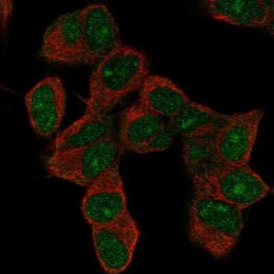 Immunocytochemistry/ Immunofluorescence: HOXD9 Antibody [NBP2-55738]