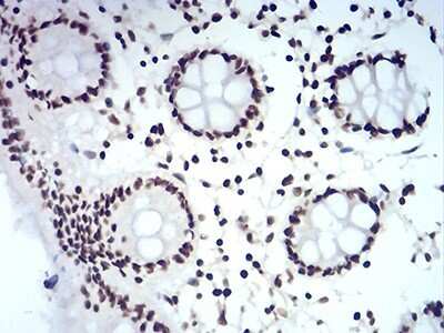 Immunohistochemistry-Paraffin: HP1 alpha Antibody (2H4E9) - BSA Free [NBP2-52420]