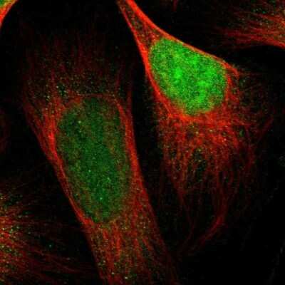 Immunocytochemistry/ Immunofluorescence: HP1 alpha Antibody [NBP1-89672]