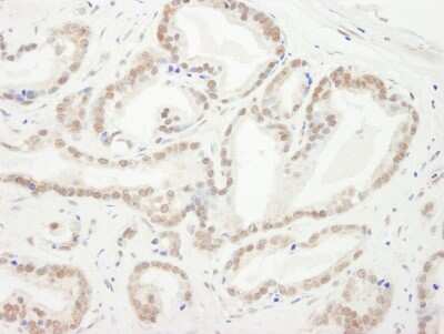 Immunohistochemistry-Paraffin: HP1 alpha Antibody [NB110-40623]