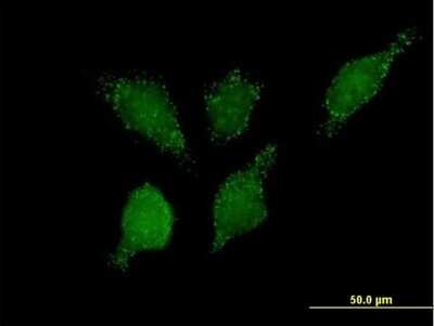 Immunocytochemistry/ Immunofluorescence: HPCL Antibody [H00026061-B01P]