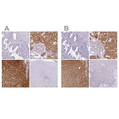 Immunohistochemistry-Paraffin: HPD Antibody [NBP1-89366]