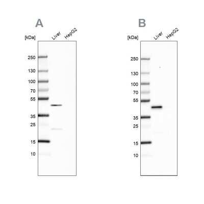Western Blot: HPD Antibody [NBP1-89366]