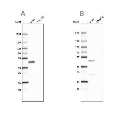 Western Blot: HPD Antibody [NBP2-32657]
