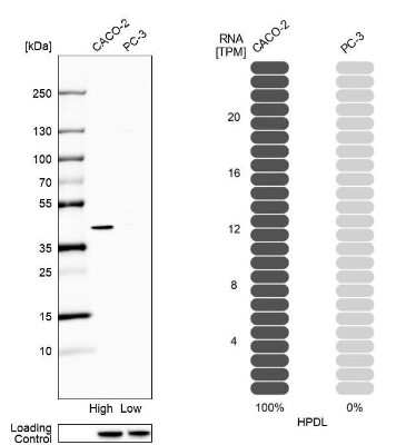 Western Blot: HPDL Antibody [NBP1-89365]