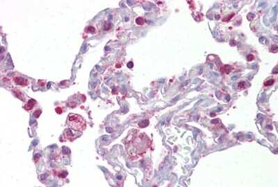 Immunohistochemistry-Paraffin: Hematopoietic Prostaglandin D Synthase/HPGDS Antibody [NBP1-54625]