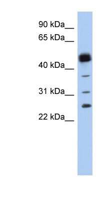 Western Blot: Hematopoietic Prostaglandin D Synthase/HPGDS Antibody [NBP1-54625]