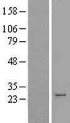 Western Blot: Hematopoietic Prostaglandin D Synthase/HPGDS Overexpression Lysate [NBL1-14330]