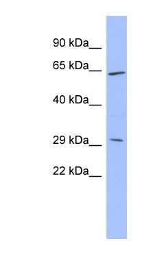 Western Blot: HPRG Antibody [NBP1-80491]