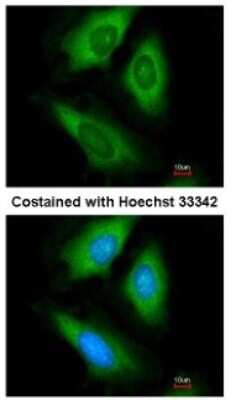 Immunocytochemistry/ Immunofluorescence: HPRT Antibody [NBP1-33527]