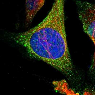 Immunocytochemistry/ Immunofluorescence: HPRT Antibody [NBP1-92006]