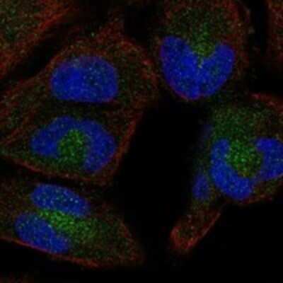 Immunocytochemistry/ Immunofluorescence: HPS5 Antibody [NBP3-17593]