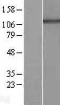 Western Blot: HPS5 Overexpression Lysate [NBL1-11699]