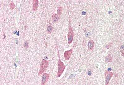 Immunohistochemistry-Paraffin: HPS6 Antibody [NB300-931]