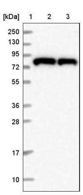 Western Blot: HPS6 Antibody [NBP2-14100]