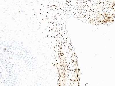 Immunohistochemistry-Paraffin: HPV16 Antibody (CAMVIR-1) [NBP2-45257]