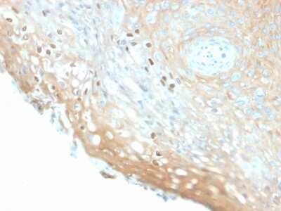 Immunohistochemistry-Paraffin: HPV16 Antibody (HPV16/2058R) - Azide and BSA Free [NBP3-08554]
