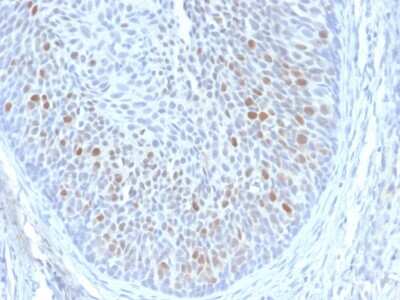 Immunohistochemistry-Paraffin: HPV16 E1+E4 Antibody (HPV16 E1/E4) - Azide and BSA Free [NBP3-08319]