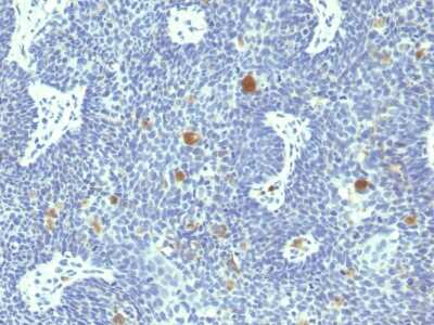 Immunohistochemistry-Paraffin: HPV18 E6 Antibody (HPV18/1297) [NBP3-07521]