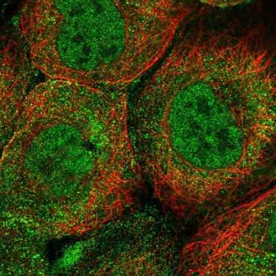 Immunocytochemistry/ Immunofluorescence: HR6A/UBE2A Antibody [NBP2-54946]