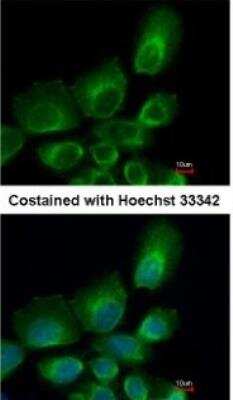 Immunocytochemistry/ Immunofluorescence: HR6B/UBE2B Antibody [NBP1-31293]