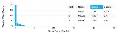 Protein Array: HR6B/UBE2B Antibody (PCRP-UBE2B-1C7) [NBP3-07169]