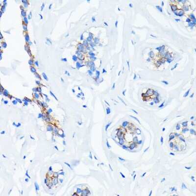 Immunohistochemistry-Paraffin: HRAS Antibody (4Q7M5) [NBP3-15818]
