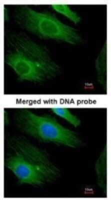 Immunocytochemistry/ Immunofluorescence: HRAS Antibody [NBP2-42864]