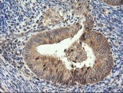 Immunohistochemistry: HRAS Antibody (OTI1D9) - Azide and BSA Free [NBP2-74847]