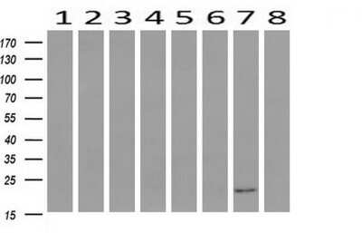 Western Blot: HRAS Antibody (OTI1D9) [NBP2-45745]