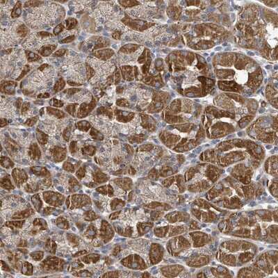 Immunohistochemistry-Paraffin: HRAS like suppressor Antibody [NBP2-14101]