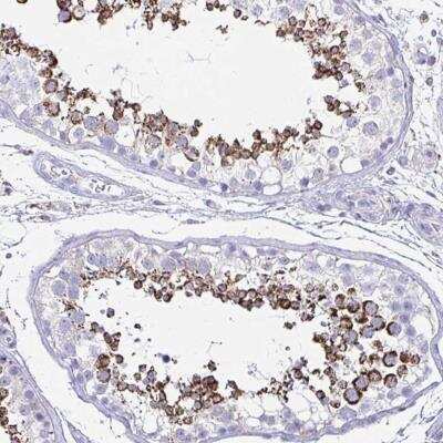 Immunohistochemistry-Paraffin: HRASLS2 Antibody [NBP2-31737]