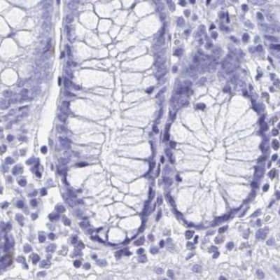 Immunohistochemistry-Paraffin: HRP-1/HDGFL1 Antibody [NBP2-14086]