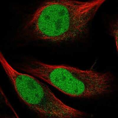 Immunocytochemistry/ Immunofluorescence: HRP-2 Antibody [NBP2-47438]