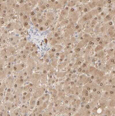 Immunohistochemistry-Paraffin: HRSP12 Antibody [NBP1-82452]