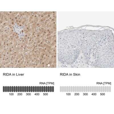 Immunohistochemistry-Paraffin: HRSP12 Antibody [NBP1-82452]