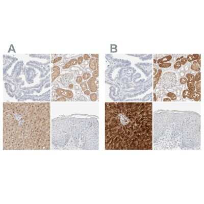 Immunohistochemistry-Paraffin: HRSP12 Antibody [NBP1-82452]