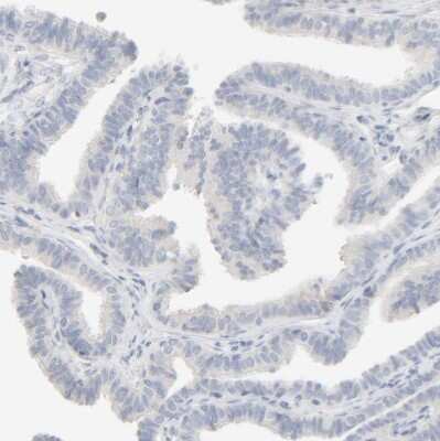 Immunohistochemistry-Paraffin: HRSP12 Antibody [NBP1-82452]