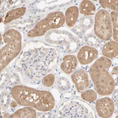 Immunohistochemistry-Paraffin: HRSP12 Antibody [NBP1-82452]