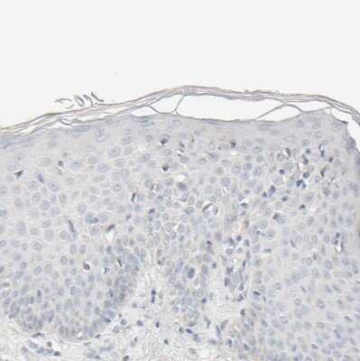 Immunohistochemistry-Paraffin: HRSP12 Antibody [NBP1-82452]