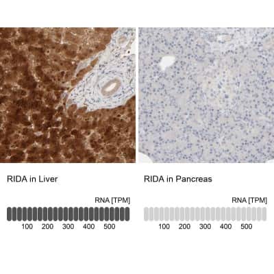 Immunohistochemistry-Paraffin: HRSP12 Antibody [NBP1-82453]