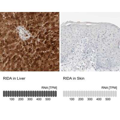 Immunohistochemistry-Paraffin: HRSP12 Antibody [NBP1-82453]