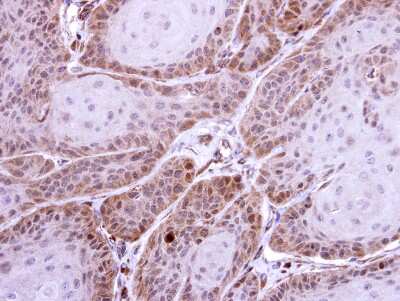Immunohistochemistry-Paraffin: HS1BP3 Antibody [NBP1-31055]