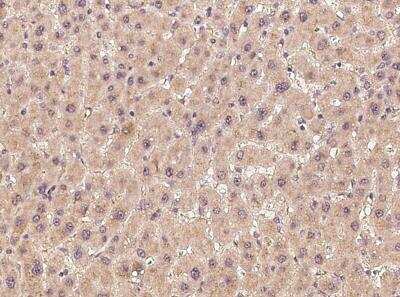 Immunohistochemistry-Paraffin: HS3ST3A1 Antibody [NBP3-06617]
