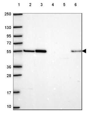 Western Blot: HS3ST3A1 Antibody [NBP2-49661]