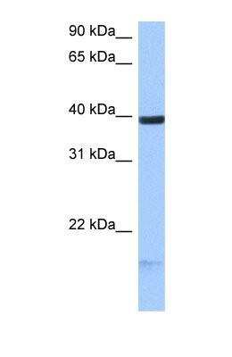 Western Blot: HS3ST5 Antibody [NBP1-69629]